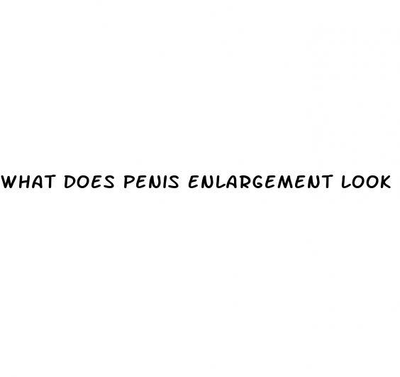 What Does Penis Enlargement Look Like