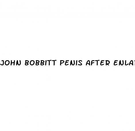John Bobbitt Penis After Enlargement