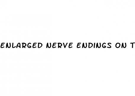 Enlarged Nerve Endings On The Penis