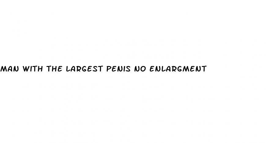 Man With The Largest Penis No Enlargment
