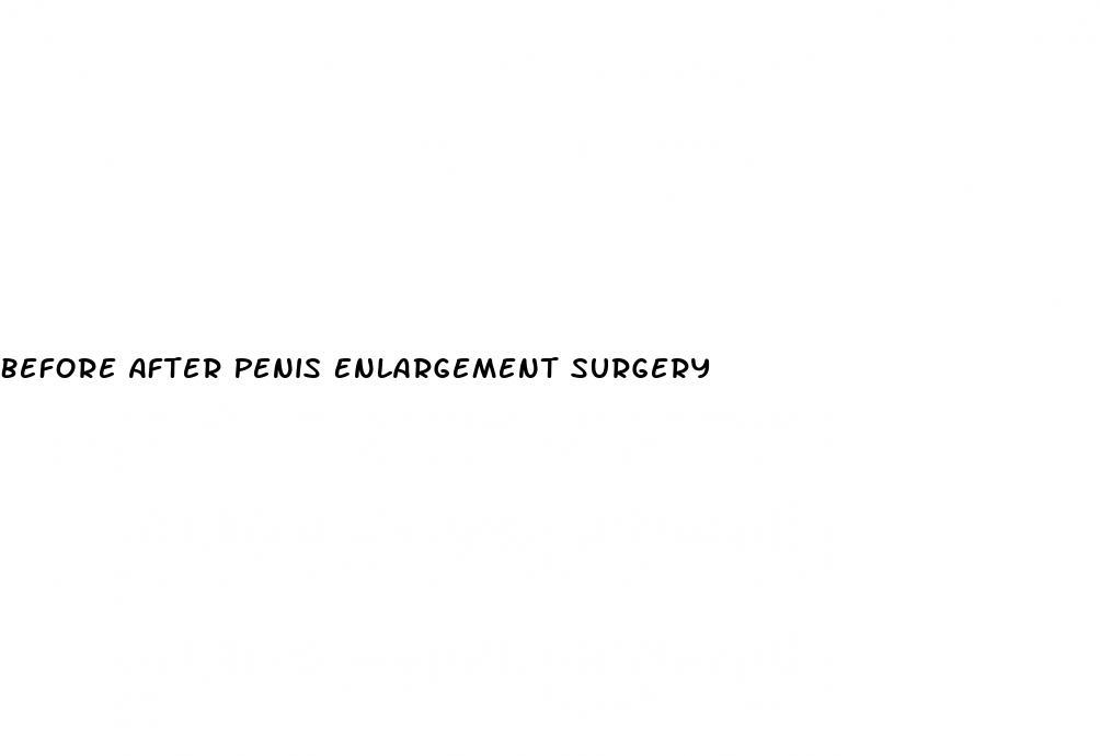 Before After Penis Enlargement Surgery