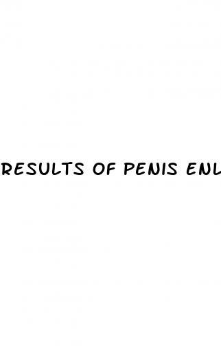 Results Of Penis Enlargement Surgery